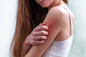 Irritated skin due to harsh dry brushing